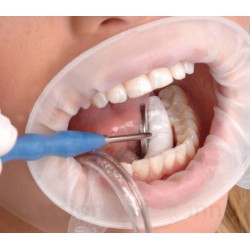 5pcs Doux Lèvre Dentaire Stérile Barrage en caoutchouc écarteur de joue Dispositif d'ouverture de bouche BLBD