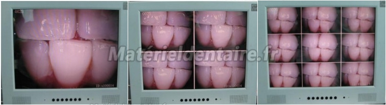 MLG® WIFI Caméra intra orale M-888
