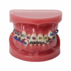 Modèle Orthodontique avec arc externe M-3005