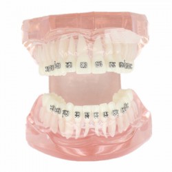 Modèle Malocclusion Correcte avec 20 Brackets M-3001