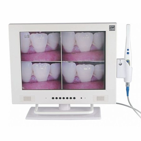 MLG® M-958A Caméra intra orale 15" écran LCD avec WIFI
