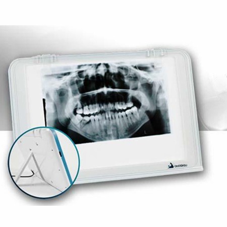 HISHINE® LUNA Négatoscope dentaire