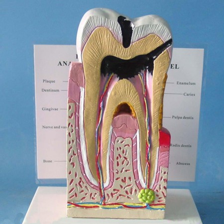 Modèle anatomique dentaire sectionné cavités dentaire Modèle agrandi