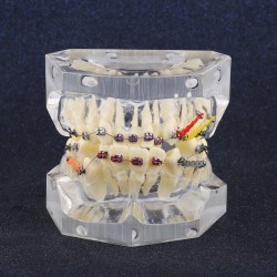 Modèle orthodontique dentaire Traitement de Malocclusion Avec crochets de chaîne SG