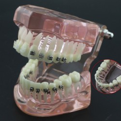 Modèle Orthodontie Contraste des brackets M3009