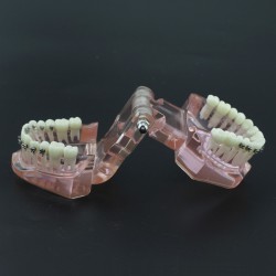 Modèle Orthodontie Contraste des brackets M3009