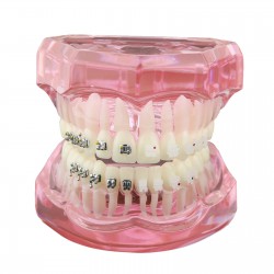 Modèle de Dents Dentaire Orthodontique Bracket métal et céramique étude 3003