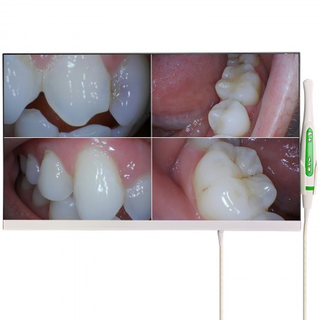 Caméra intra-orale dentaire Magenta YF-2400M avec écran 24 pouces et Wifi
