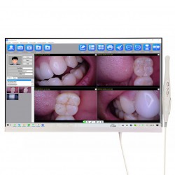 Magenta YF-2400P Caméra intra-orale dentaire à écran tactile de 24 pouces avec W...
