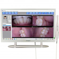 Caméra intra-orale dentaire Magenta YF-2200P+ avce écran tactile de 21,5 pouces
