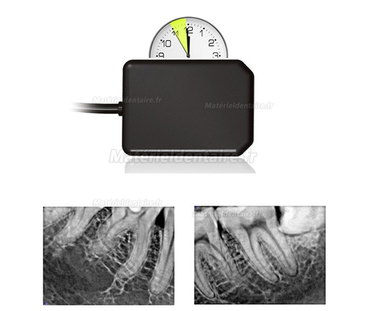 Appareil radiographie portable AD-60P + Handy HDR 500 capteur radio dentaire