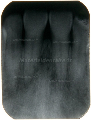 Appareil Radiographique dentaire portable BLX-5