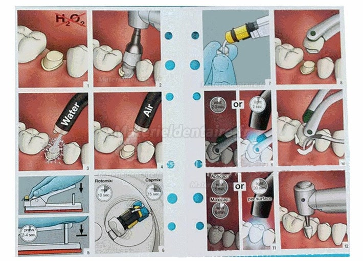 Universal Dental Capsule Activateur + Applicateur Gun (3M,GC Fuji Capsule, etc.)