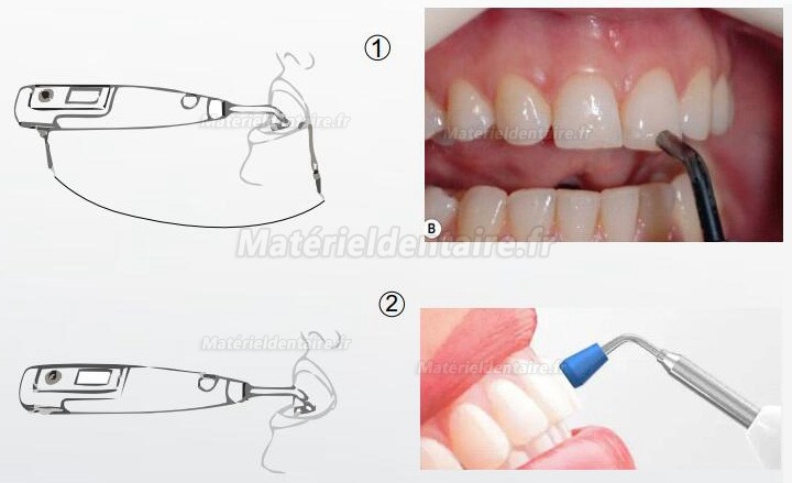 Denjoy MeteEndo Système intégré endo dentaire (avec Meta Fill/Meta Pex/Meta Motor/Meta Pulp/Meta Pack) Denjoy MeteEndo Système intégré endo dentaire (avec Meta Fill/Meta Pex/Meta Motor/Meta Pulp/Meta Pack)