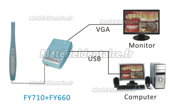 Caméra intra orale par fil de Modèle FY710 + FY660