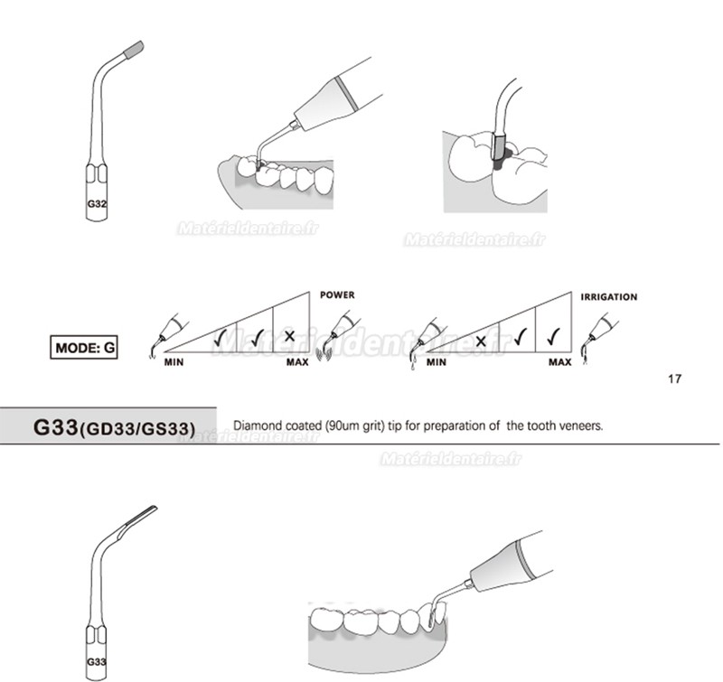 5 Pièces Refine® Inserts piézo pour la restauration G20 G21 G30 G31 G32 G33 G35 compatible avec EMS Woodpecker