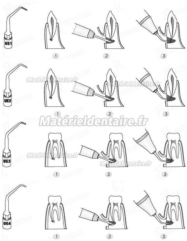 WOODPECKER® INSERTS A PIEZO CHIRURGIE ENDODONTIE KIT 4 INSERTS