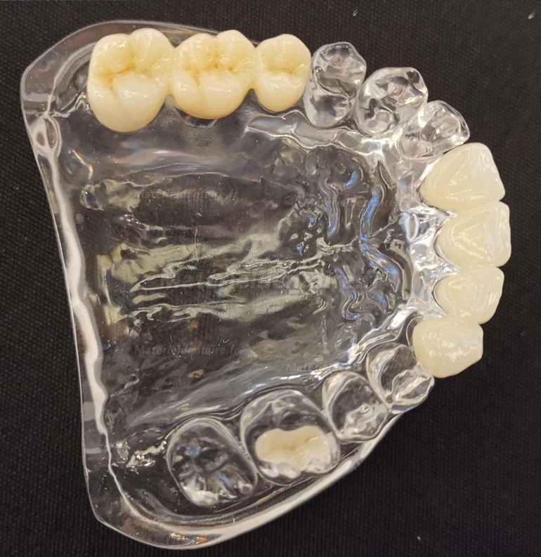 Kingch® 3D-M 98/95mm disques zircone multicouche laboratoire dentaire