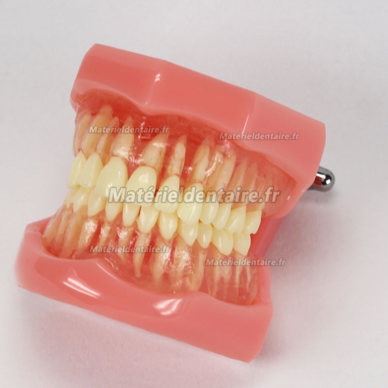 Modèle dentaire d'études standard Dent Amovible