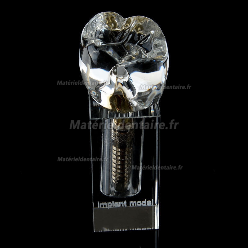 Modèle Cristal d'implant dentaire M2019-II