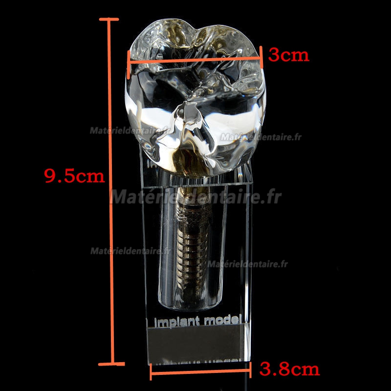 Modèle Cristal d'implant dentaire M2019-II