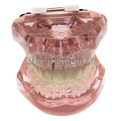 Modèle dentaire M-3004 restauration linguale