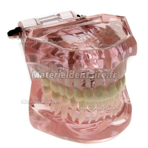 Modèle dentaire M-3004 restauration linguale