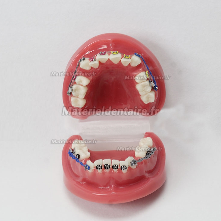 Modèle Orthodontique avec arc externe M-3005