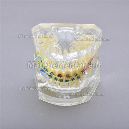 Modèle dentaire M-3005 II traitement des chevauchements dentaires
