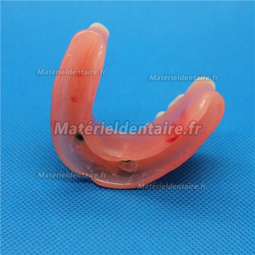 Modèle dentaire pour réparation d’implant dentaire M-6007