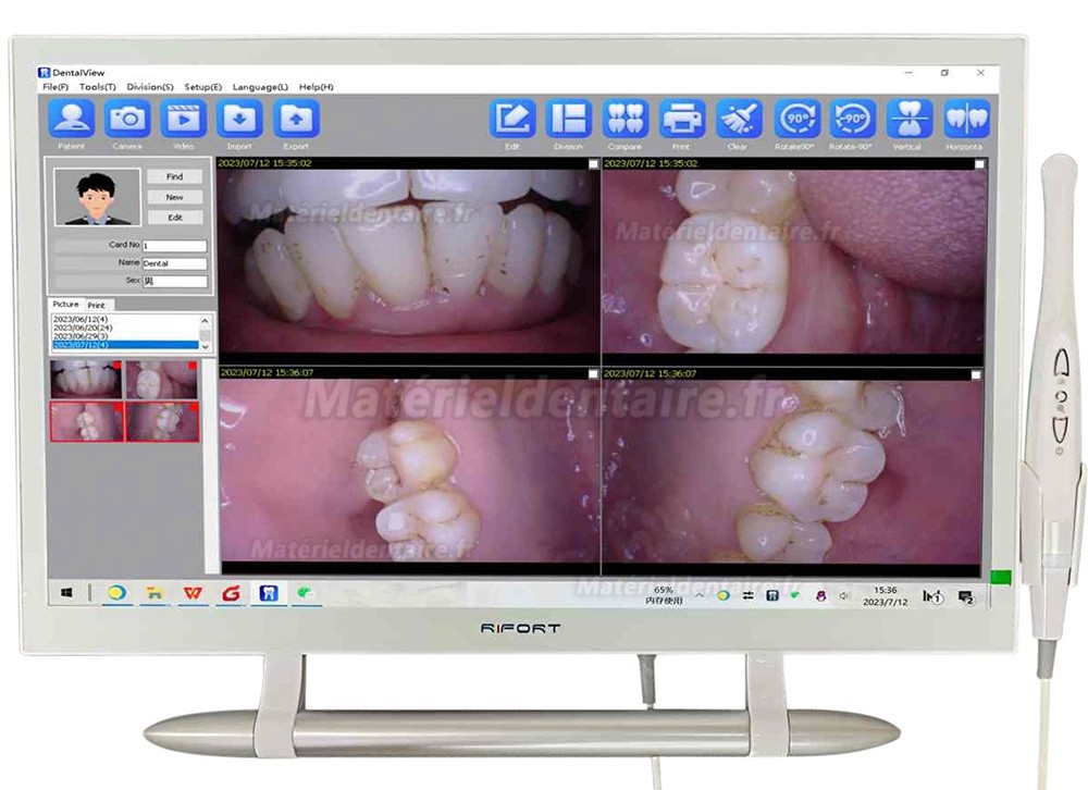 Caméra intra-orale dentaire Magenta YF-2200P+ avce écran tactile de 21,5 pouces