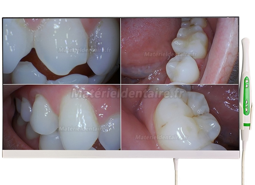 Caméra intra-orale dentaire Magenta YF-2400M avec écran 24 pouces et Wifi