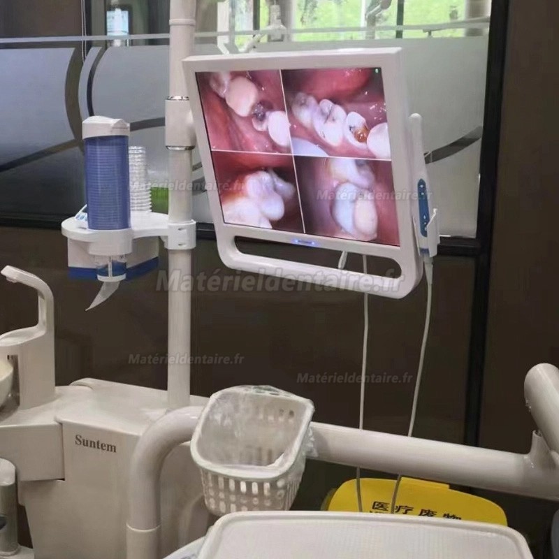 Caméra intra-orale dentaire Magenta YF1700M avec écran 17 pouces et WIFI