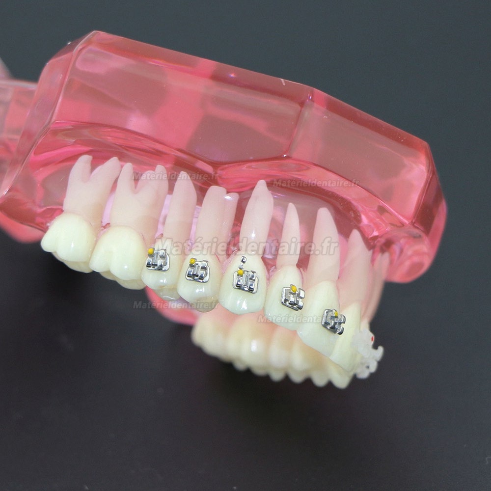 Modèle de Dents Dentaire Orthodontique Bracket métal et céramique étude 3003