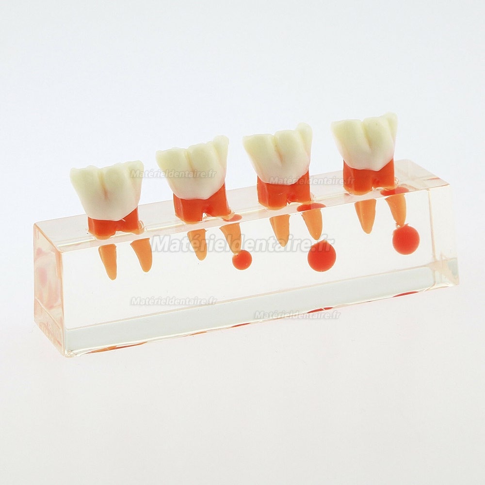 73/5000 Étude de traitement endodontique à 4 étapes de modèle de dents dentaires Teach Model 4018 01