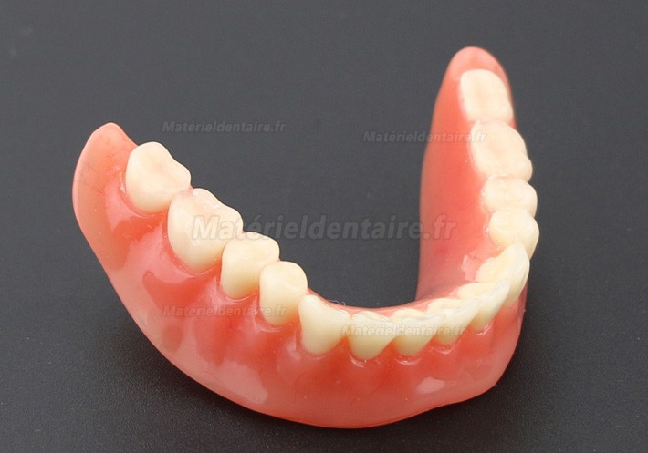 Prothèse Modèle Dentaire Couvert-dentier Inférieur avec 2 Implantations d’Étude de Démo Modèle 6002 01