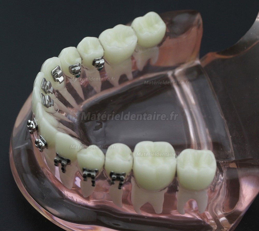 Modèle Orthodontie Contraste des brackets M3009