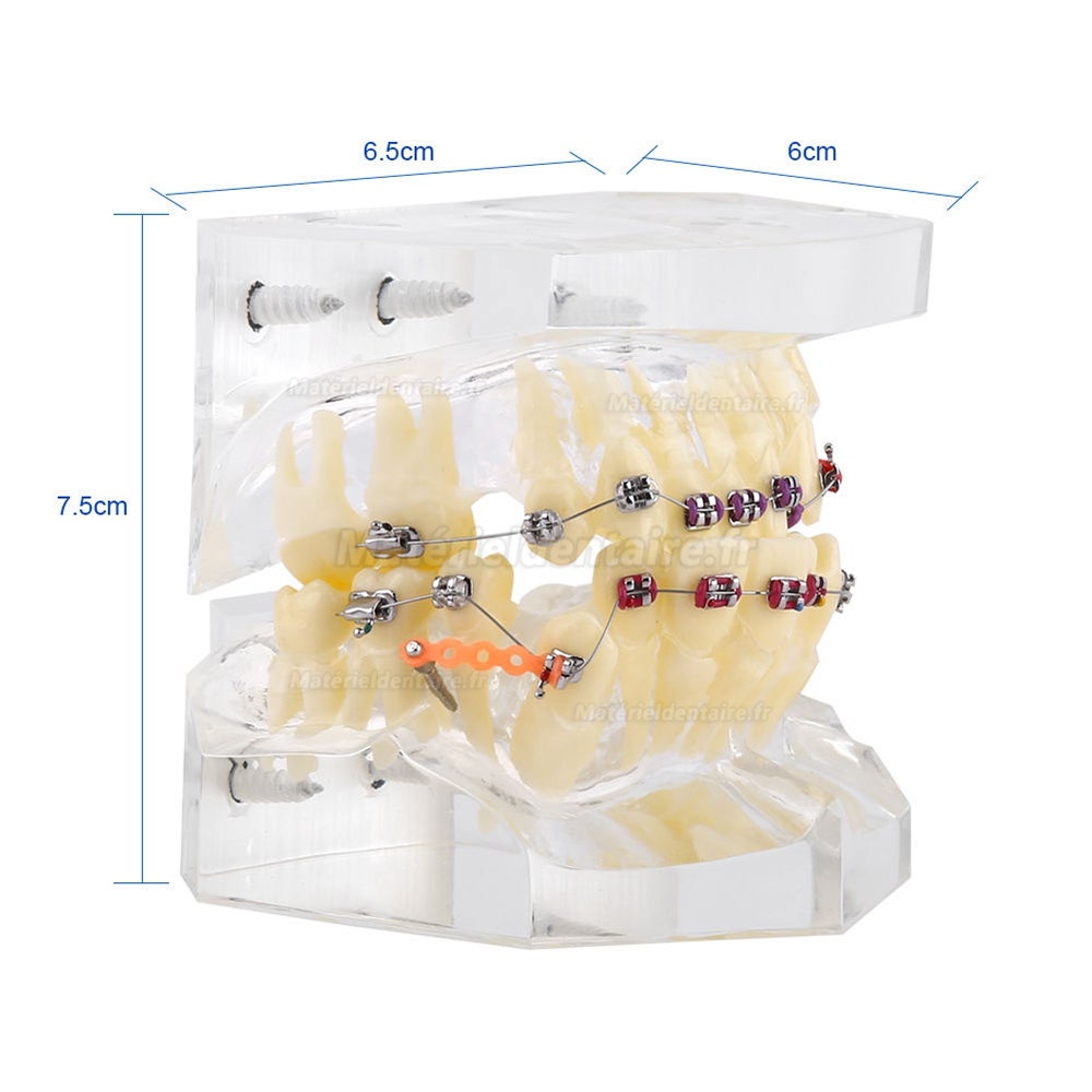 Modèle orthodontique dentaire Traitement de Malocclusion Avec crochets de chaîne SG