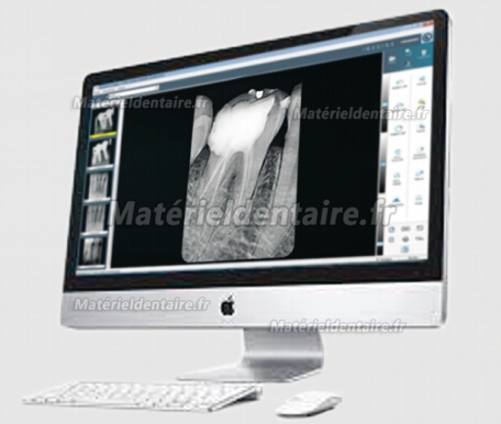 VISIODENT® Capteur plan intra-oral RSV4 pour radiographie dentaire