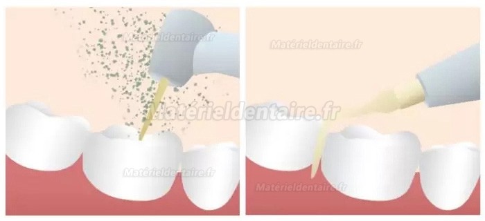 Refine MaxSurgery Appareil piézochirurgie dentaire /appareil chirurgie ultrasonique