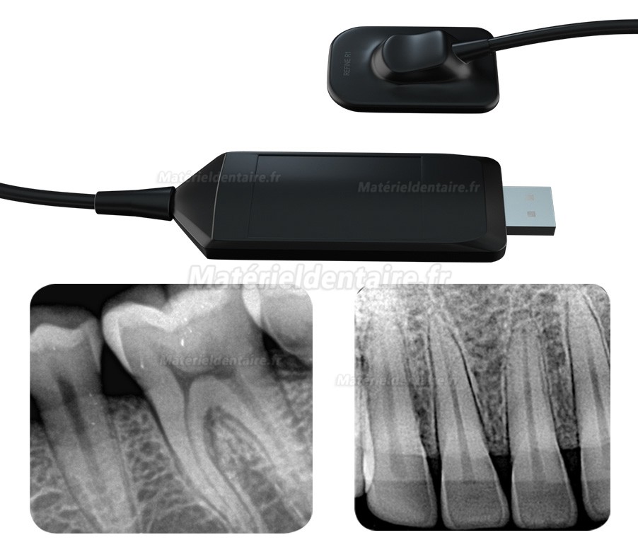 Capteurs intra-oraux numériques portables USB à capteur RVG dentaire Refine R1/R2