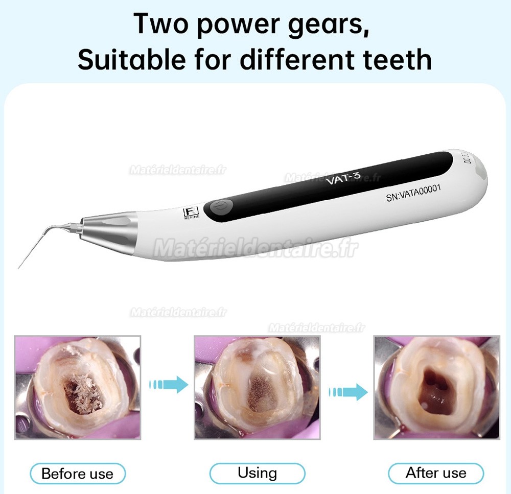 REFINE VAT-3 ultrasonic activator (endoactivator)