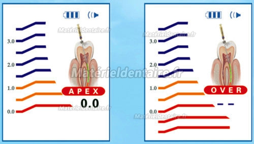 ZP® Localisateur d’apex écran en couleur SR-100