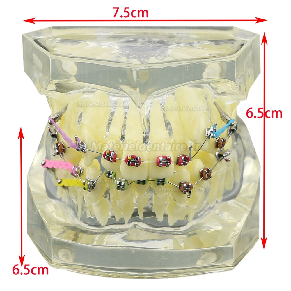 Modèle de dents orthodontiques dentaires + Chaîne auto-ligaturante pour tube de support en céramique et métal