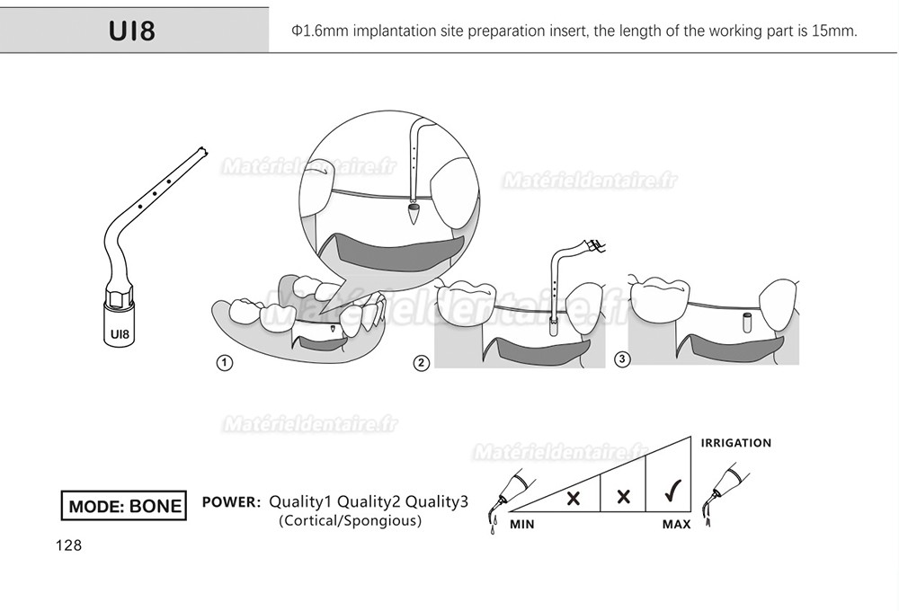 1 Pièces Inserts pour sinus lift latéral Ul1 UI2 UI3 UI4 UI5 compatible avec Mectron Woodpecker Silfradent Dmetec