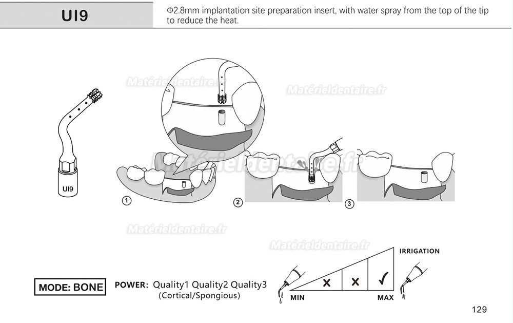 1 Pièces Inserts pour sinus lift latéral Ul1 UI2 UI3 UI4 UI5 compatible avec Mectron Woodpecker Silfradent Dmetec