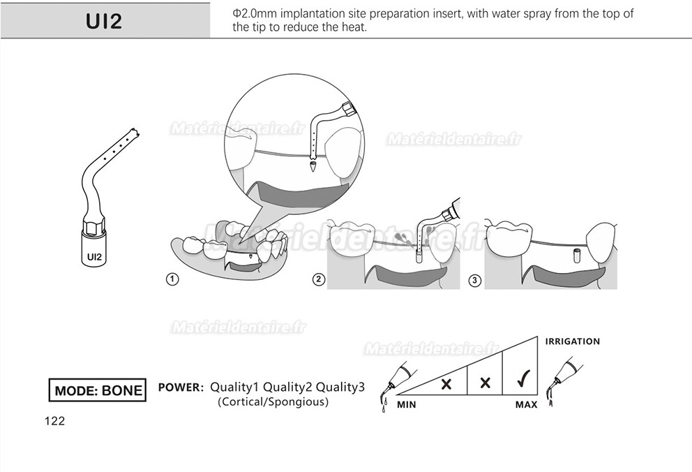 1 Pièces Inserts pour sinus lift latéral Ul1 UI2 UI3 UI4 UI5 compatible avec Mectron Woodpecker Silfradent Dmetec