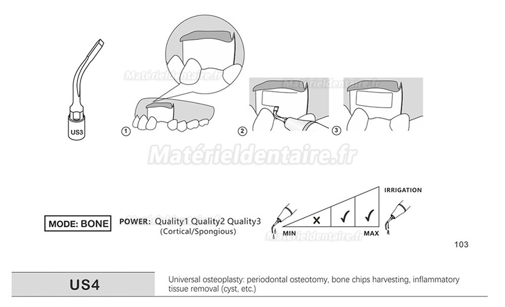 1 Pièces Inserts piezosurgery pour la chirurgie osseuse US1 US1L US1R US2 US3 US4 US5 US6 US7 US11 US12 compatible avec Mectron Silfradent Dmetec Woodpecker