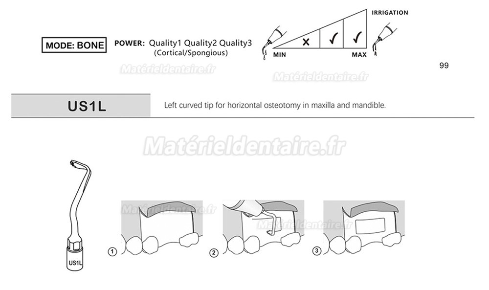 1 Pièces Inserts piezosurgery pour la chirurgie osseuse US1 US1L US1R US2 US3 US4 US5 US6 US7 US11 US12 compatible avec Mectron Silfradent Dmetec Woodpecker