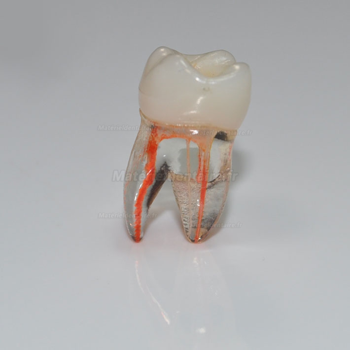 Modèle anatomique dentaire détachable, dent unique